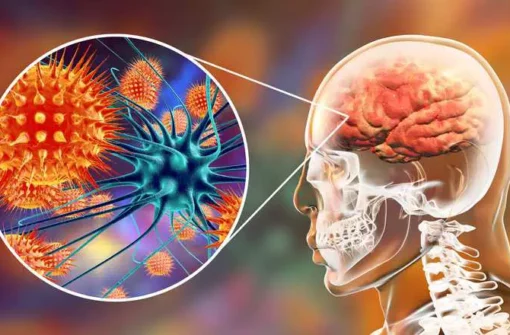 Vírus Nipah: Surto na Índia coloca autoridades de saúde em alerta global e exige vigilância no Brasil